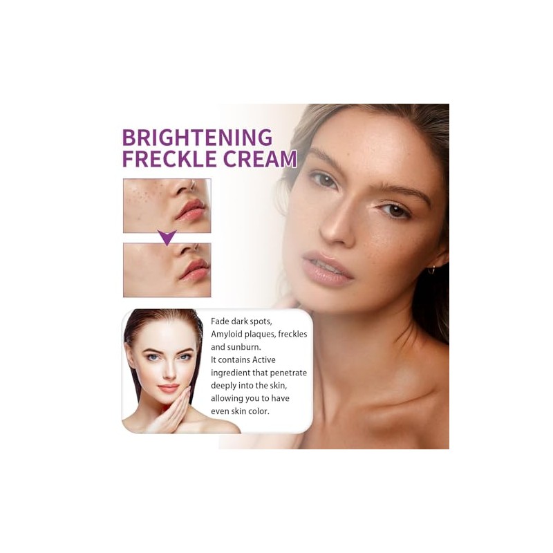 2 Piezas Crema de Urea que Decolora las Manchas, Crema