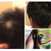 Vanessa Producto 100% Natural Mexicano 2 BOTTLES, HAIR REGROWTH SHAMPOO