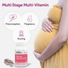 Nutri Supreme Prenatal Vitamin, Chewable Prenatal Vitamins for Women with