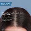 Ducray Kelual Squanorm Moisturizing Shampoo For Oily Loose Dandruff 200mL