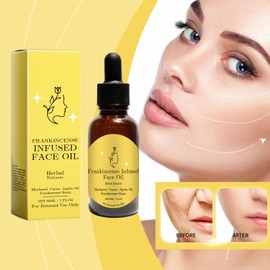 2 Stück Frankincense Resin Oil For Face, Frankincense Resin Infused Oil Bio Weihrauchöl Frankincense Oil Verstärkendes Anti-Falten-Serum Rizinus- Und Jojobaöle Für Das Gesicht, Skincare Hydrates