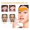 Parches Anti Arrugas Mascarilla Facial Colágeno Frente 30pzs