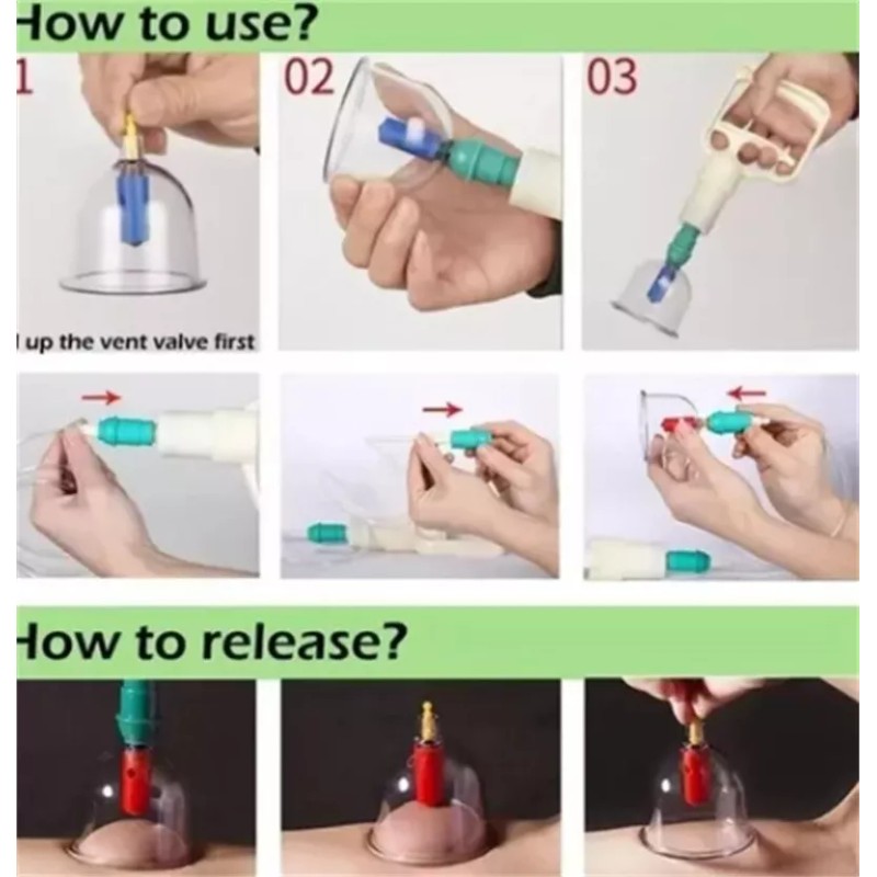BU Kit 12 Ventosas Terapeuticas Desintoxicacion Neumaticas