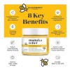 Manuka Relief,crema De Miel Para Eccema, Psoriasis,dermatiti