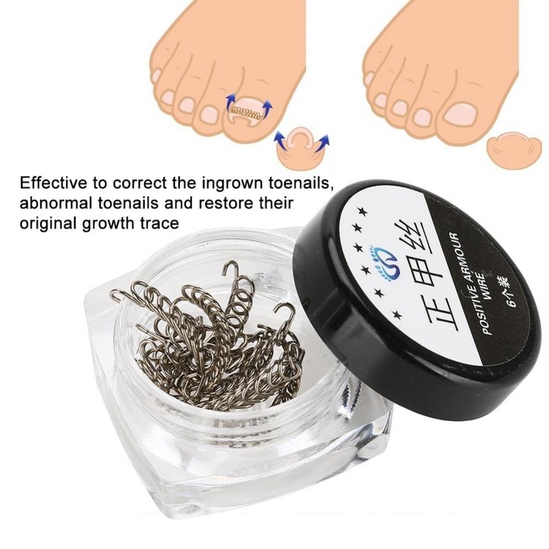 Nail Corrector Pedicure ment Foot Care Tool, 12Pcs/Box Toenail Correction