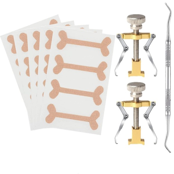 Say Goodbye to Ingrown Toenails with Our Professional Correction Patch