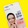 Nasolabial fold lifter corrector bulldog cheek lifting cheek sagging lifting / 팔자주름 리프터 교정기 불독살리프팅 볼처짐리프팅
