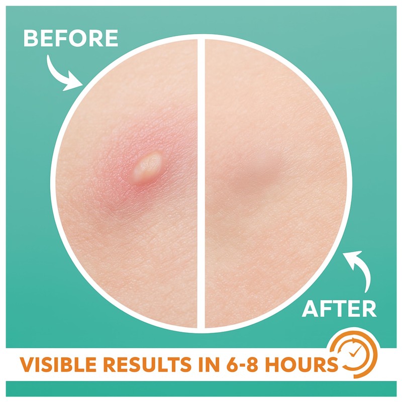 Glow Drift Acne Patches – 36 Count | Korean-Inspired Invisible