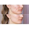 Ammuri Organic Black Seed Oil for Radiant Skin