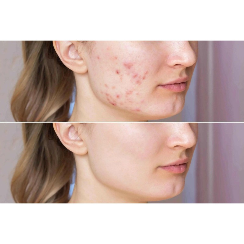 Ammuri Organic Black Seed Oil for Radiant Skin