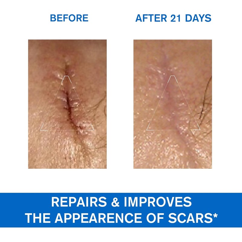 Uriage Bariederm-Cica Crema Reparadora