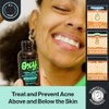 Oxy Vitamin C Serum + Hyaluronic Acid For Face