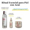 Kit Tratamiento Acné Lilo Skincare Té Verde Y Niacinamida