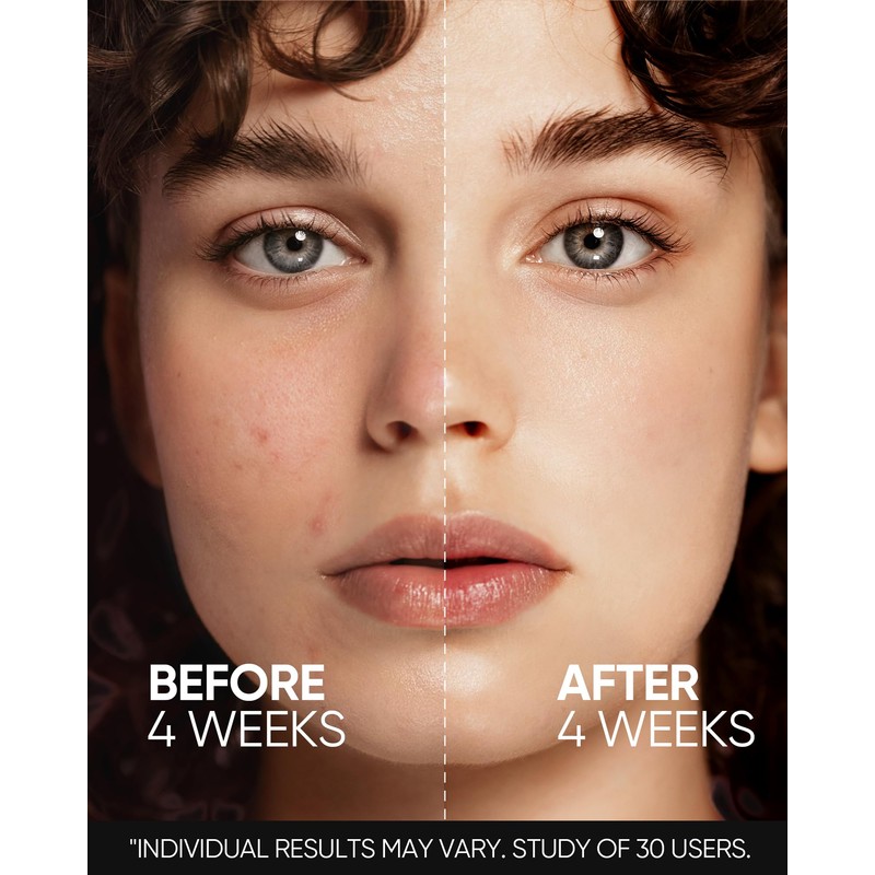 SKINTIFIC Retinol Skin Renewal Serum for Face, Blemish Care, Oil