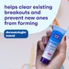 JJ Persa-Gel Acne Tr MS Size 1z Clean Clear Maximum