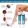 2 Cremas Profesional Anti Varices Elimina Venas Piernas