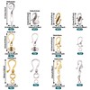 Beadthoven 60sets 8 Styles Tibetan S Hook Ring Toggle Clasps