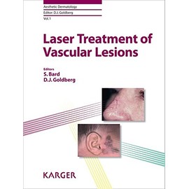 Laser Treatment of Vascular Lesions