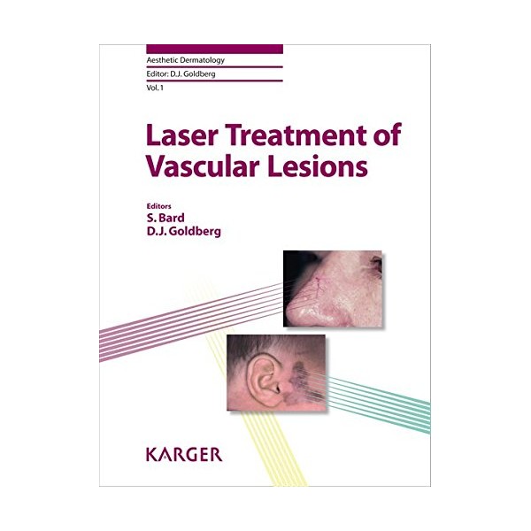 Laser Treatment of Vascular Lesions