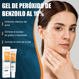 Gel Peróxido Benzoilo 10% Eliminar La Cabeza Negra Del Acné
