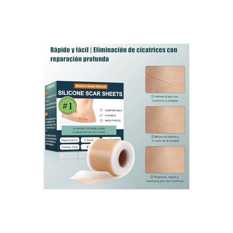 Parches de Silicona para Eliminar Cicatrices, Tratamiento Profesional para Cicatrices