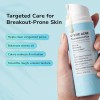 Tratamiento Bellamiluxx Para El Acné Quístico Facial: Crema