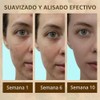 Jabón Cúrcuma Manchas Crema Oscuras Cara