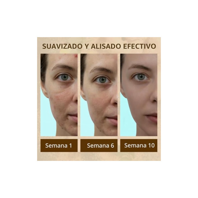 Jabón Cúrcuma Manchas Crema Oscuras Cara