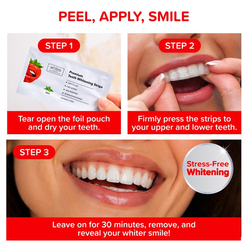 Whites Beaconsfield Teeth Whitening Strips, 60 Strips (30-Day Treatment) –