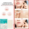 Parches Invisibles Acné Espinillas Facial Absorbente 72pz F