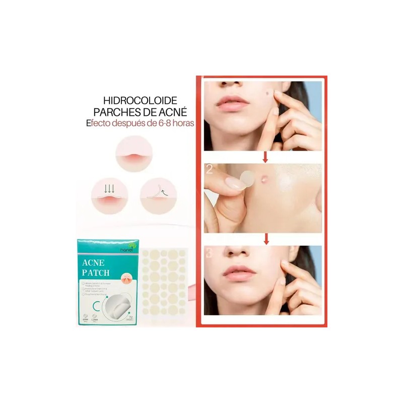 Parches Invisibles Acné Espinillas Facial Absorbente 72pz F