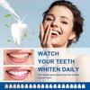 LUCKIN SMILE 22% Carbamide Peroxide Teeth Whitening Gel – Professional