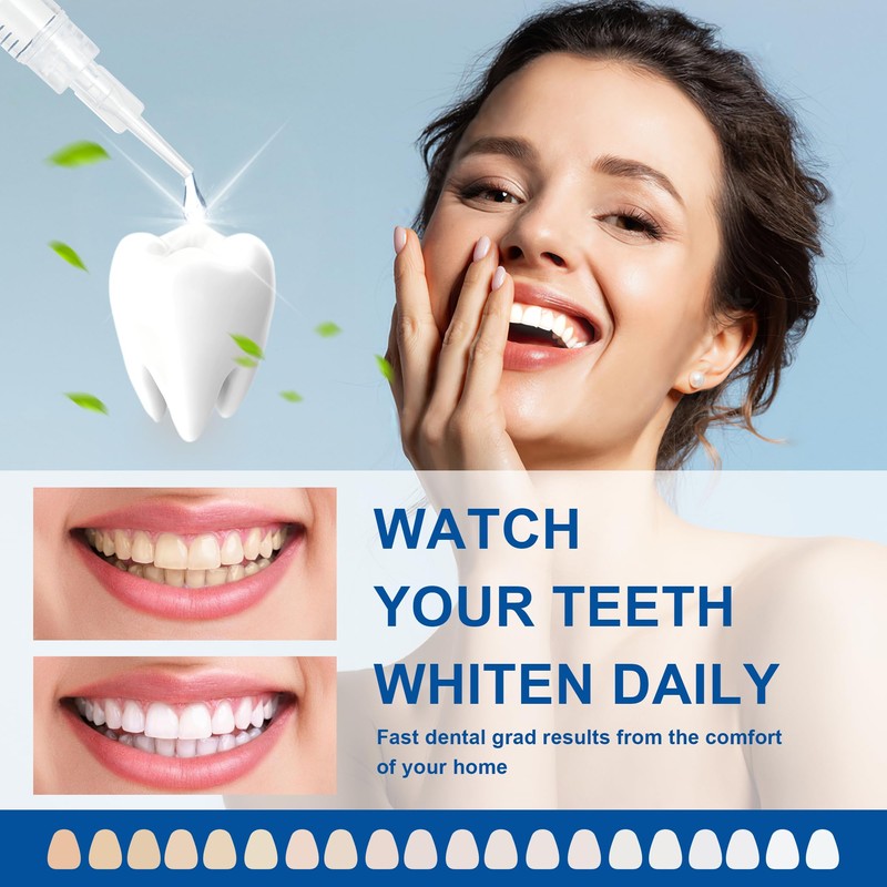 LUCKIN SMILE 22% Carbamide Peroxide Teeth Whitening Gel – Professional