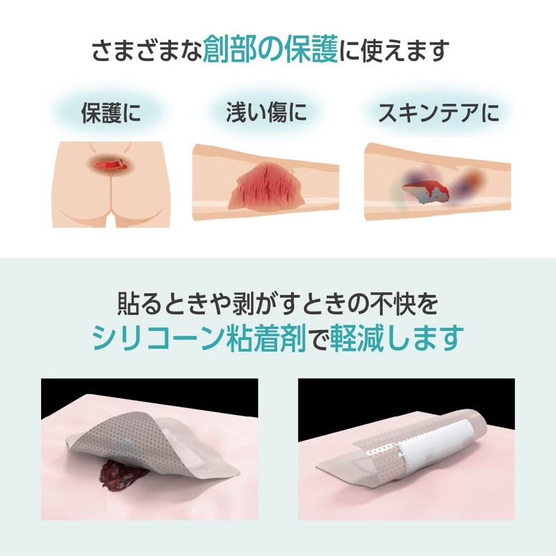 オプティフォーム ジェントル EX 10.1cmx10.1cm(中)10枚入 創傷被覆材 創部保護 防水 絆創膏 大判 褥瘡対策