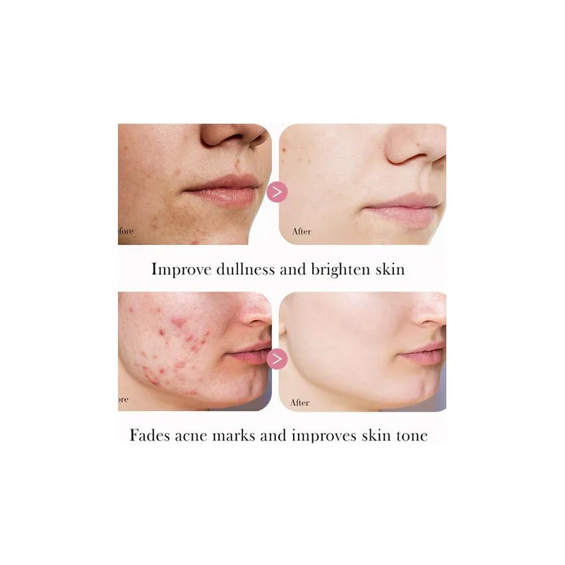 Srum Reafirmante Facial Con cido Hialurnico Para Arrugas