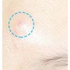 Hatherine Spot Care Patch Kit, 76 patches, 2 packs 해서린