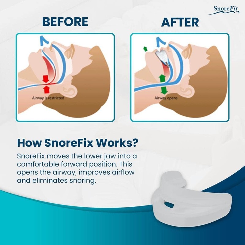 SnoreFix 4 Pack, 2 Years Supply, One Size Fits All,