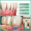 Gum Regrowth Drops,30ml Gum Repair for Receding Gums,Natural Gum Restore