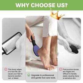 Hard Skin Remover Nano Glass Foot File - Callus Remover for Feet, Durable Foot Scrubber, Effective Dead Skin Remover, Hygienic Pedicure Tool, Long Lasting Foot Buffer, Soft Smooth Feet (Black)