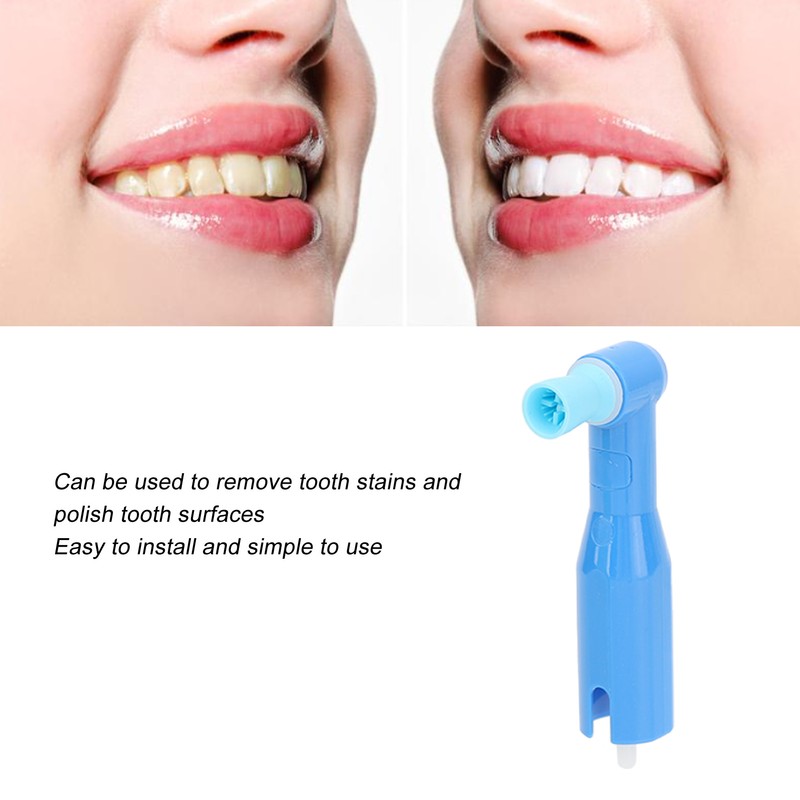 100pcs Oral Polishing Cup Kits Teeth Stains Removal Disposable Polisher