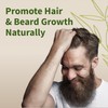 Hair Growth Supplement - Promotes Hair Regrowth, Stops Hair Loss