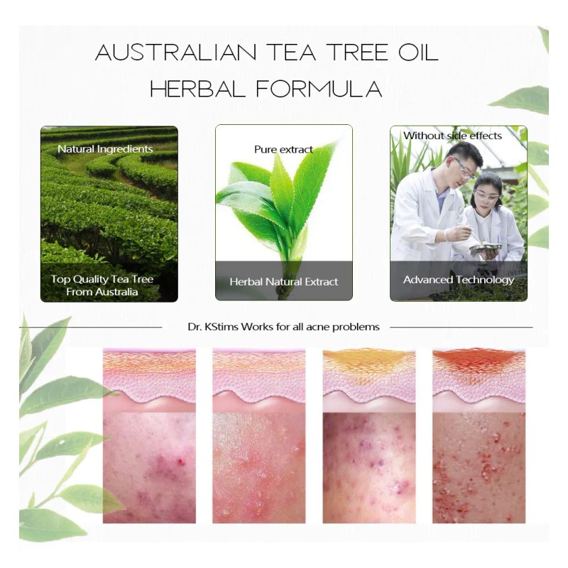 Crema Eliminadora De Espinillas Coreana Para El Cuidado De L