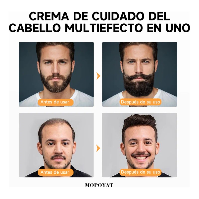 Crema Para El Crecimiento Del Cabello Y La Barba (20