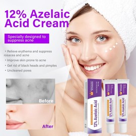 12% Azelaic Acid Serum, 2 Pieces Azelaic Acid, Azelaic Acid Cream, Azelaic Acid Face Serum, 12% Azelaic Acid Serum, Azelaic Acid Serum Against Redness, Anti Pimples and Acne Serums