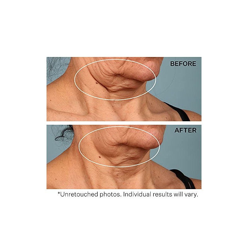 Strivectin Crema Cuello Ounces 19415 Gramo