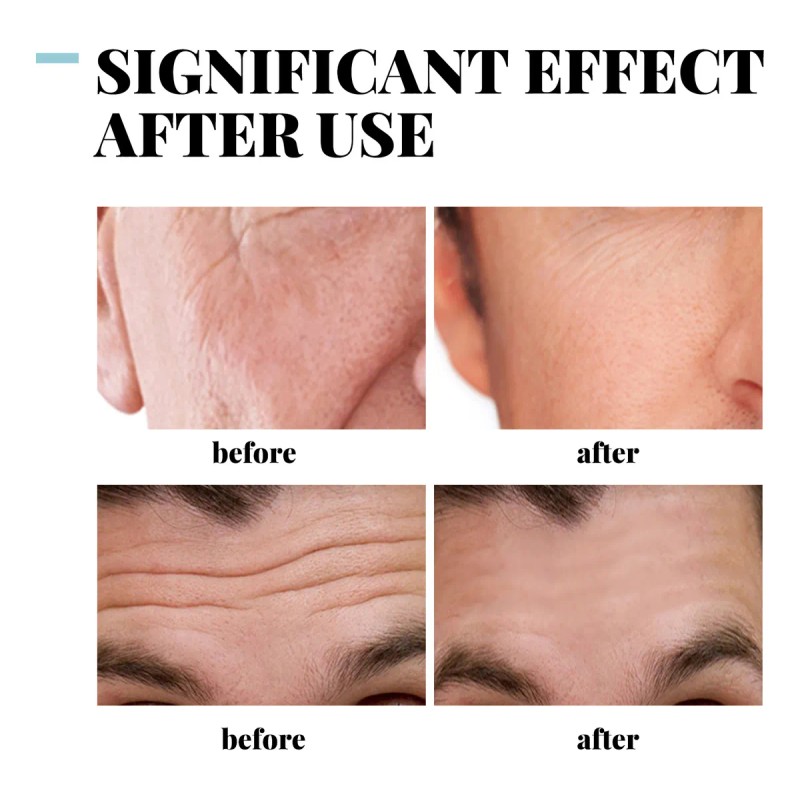 Crema Facial Suave E Hidratante For Hombre.