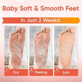Foot Peel Mask - Foot Mask for Baby Soft Skin - Remove Dead Skin, Dry, Cracked Feet & Callus, Foot Spa, Made with Aloe Vera Extract for Women and Men (3 Pairs Peach)