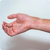 Derman Atopi Calm Crema Corporal │ Urea-D 5% + Avena