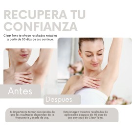 Crema Despigmentante Clear Tone - Manchas Solares Y Por Edad