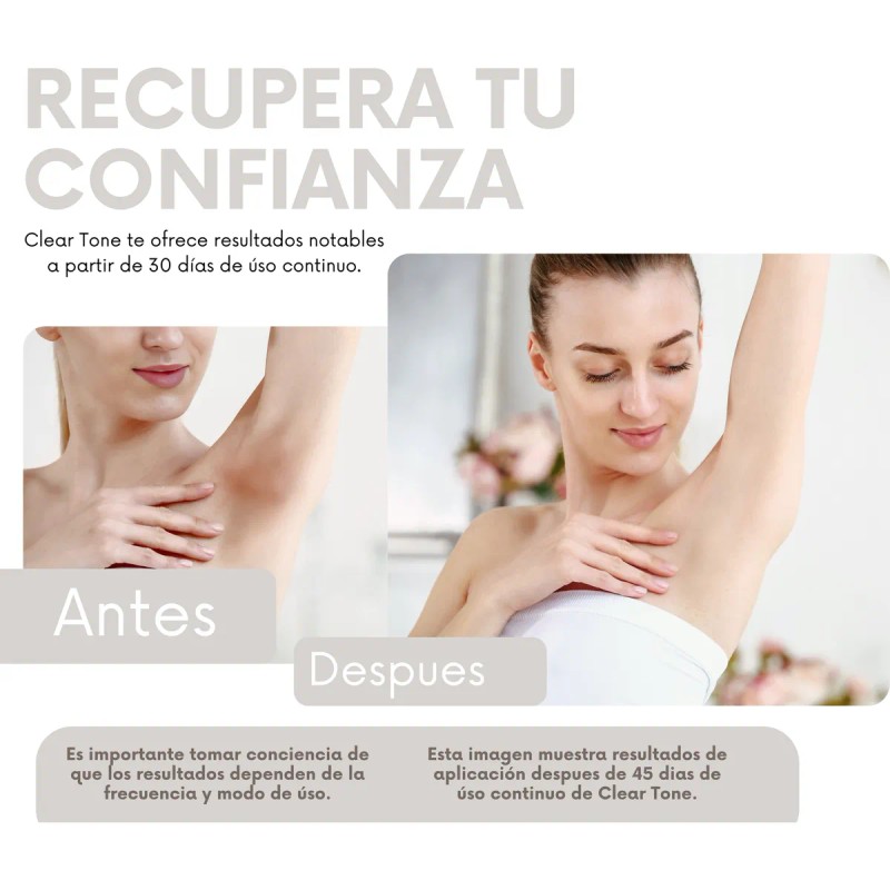 Crema Despigmentante Clear Tone - Manchas Solares Y Por Edad